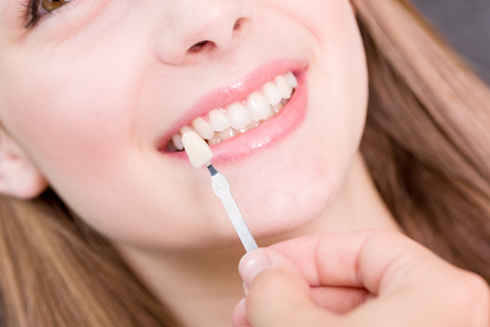 Everything about Dental Crowns