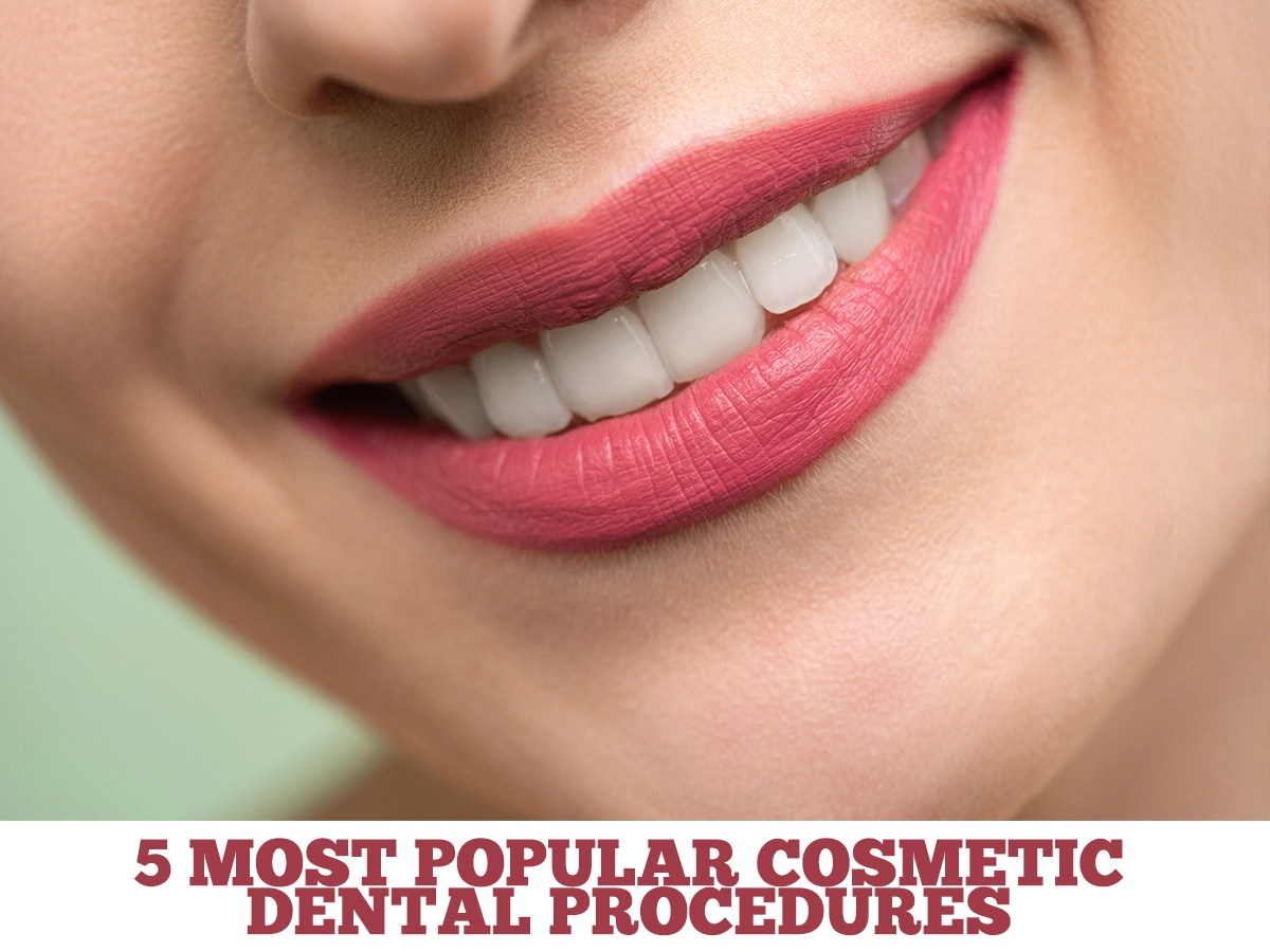 5 Most Popular Cosmetic Dental Procedures