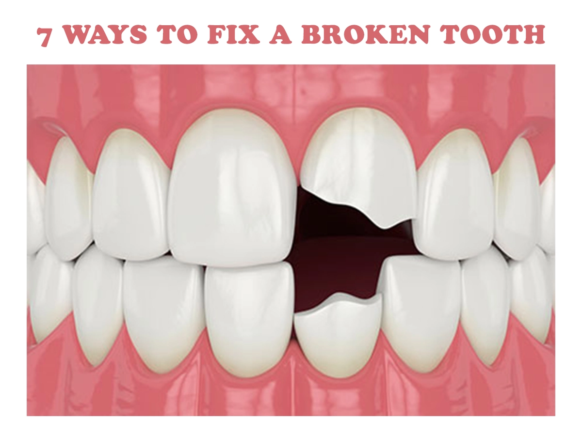 7 Ways to Fix a Broken Tooth