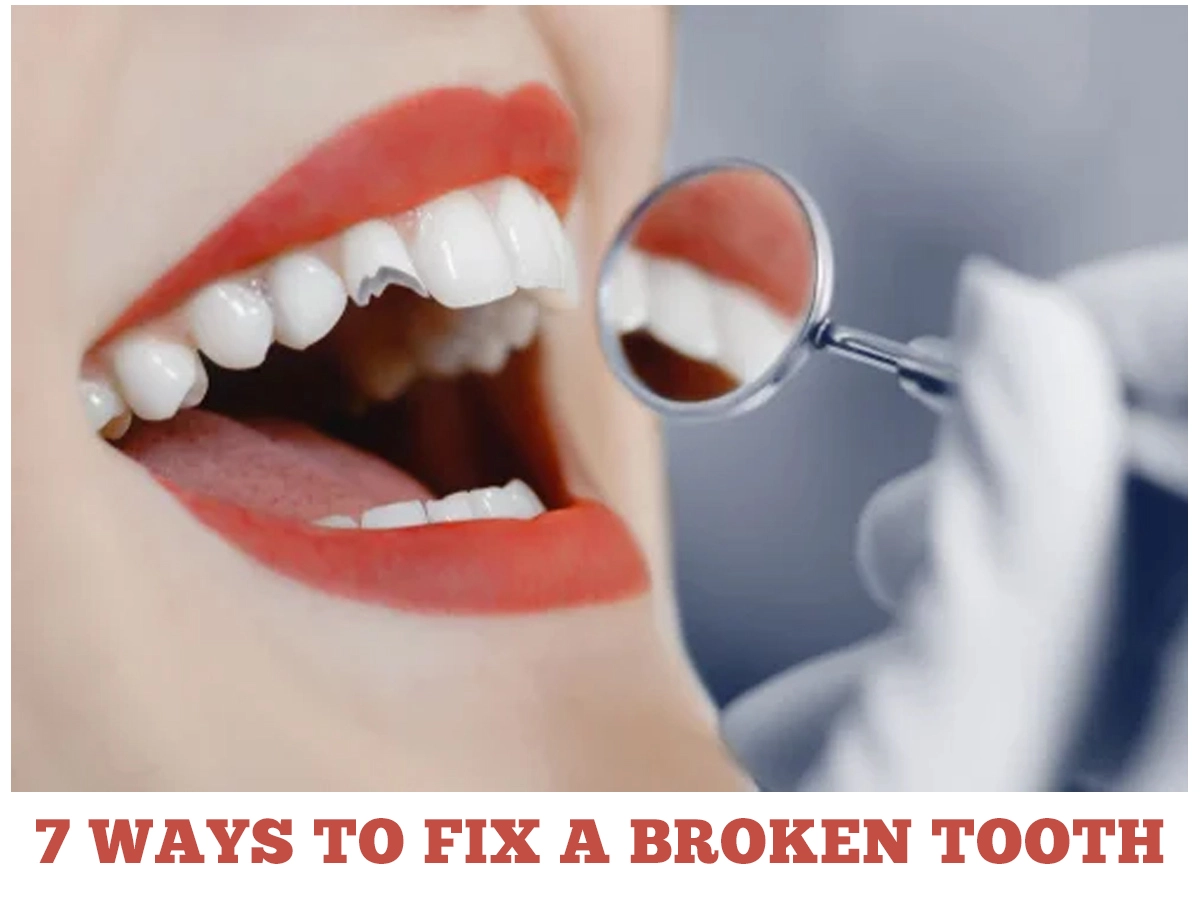 7 Ways to Fix A Broken Tooth