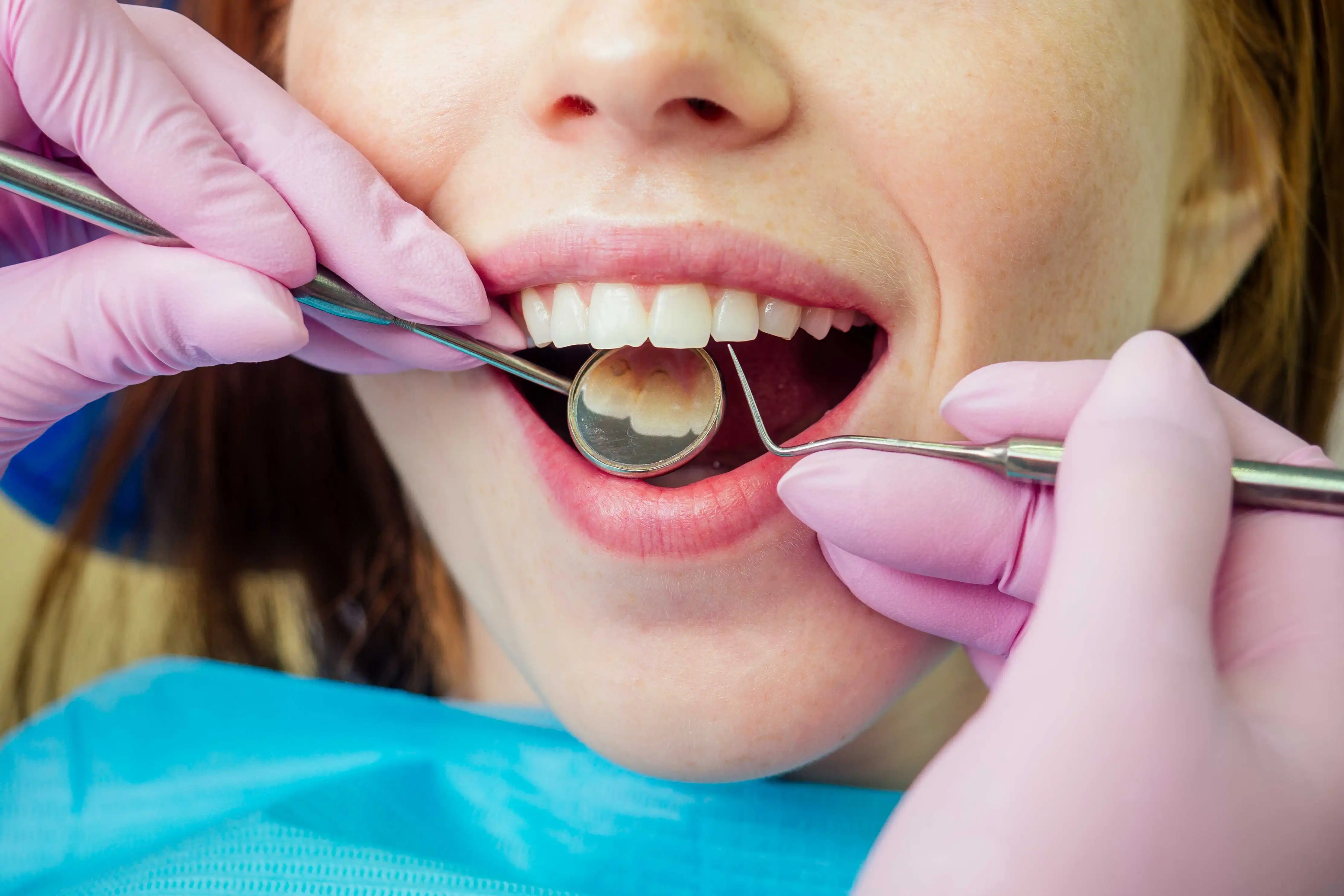 What are Cosmetic Dental Procedures?