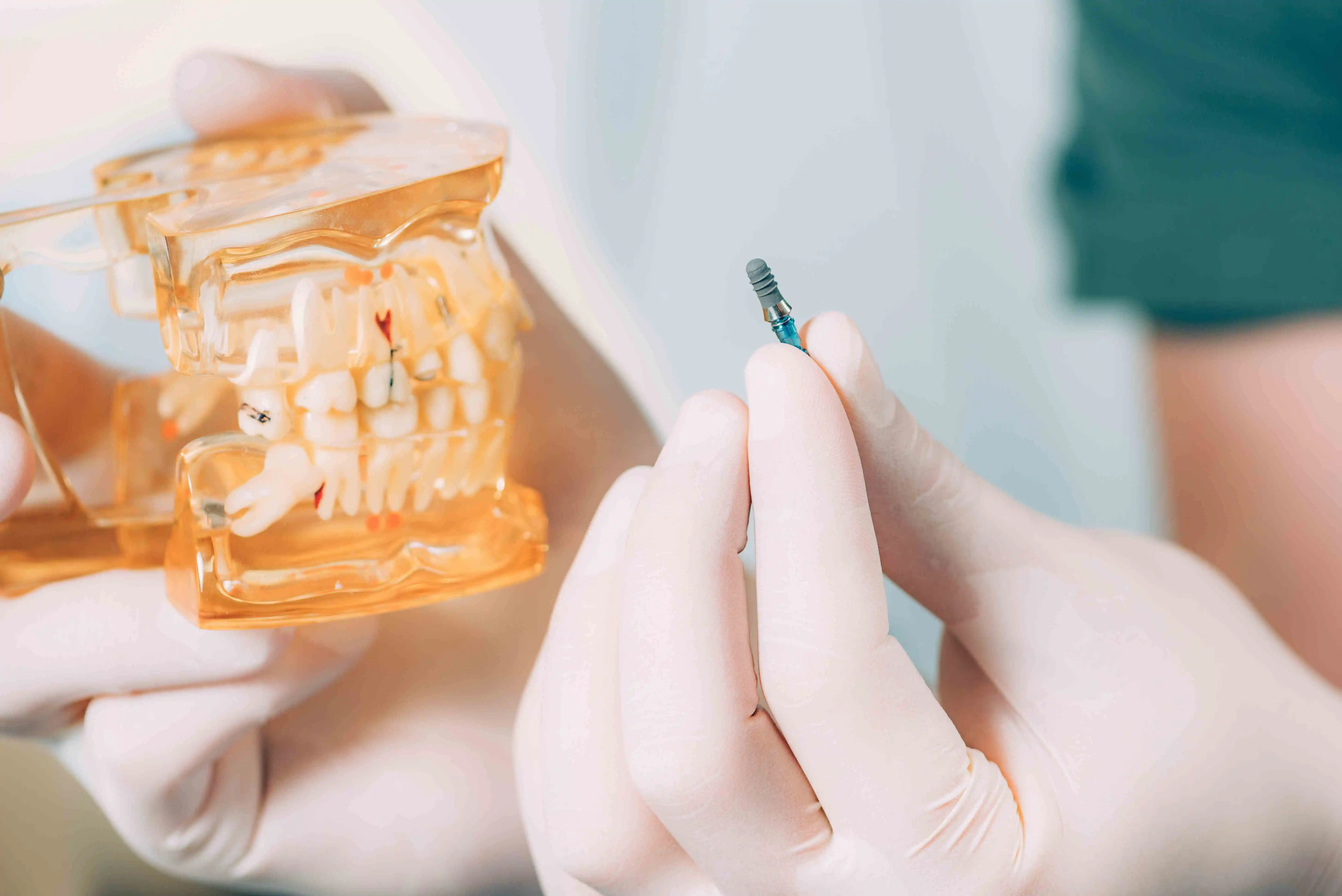 dentist holding dental implants