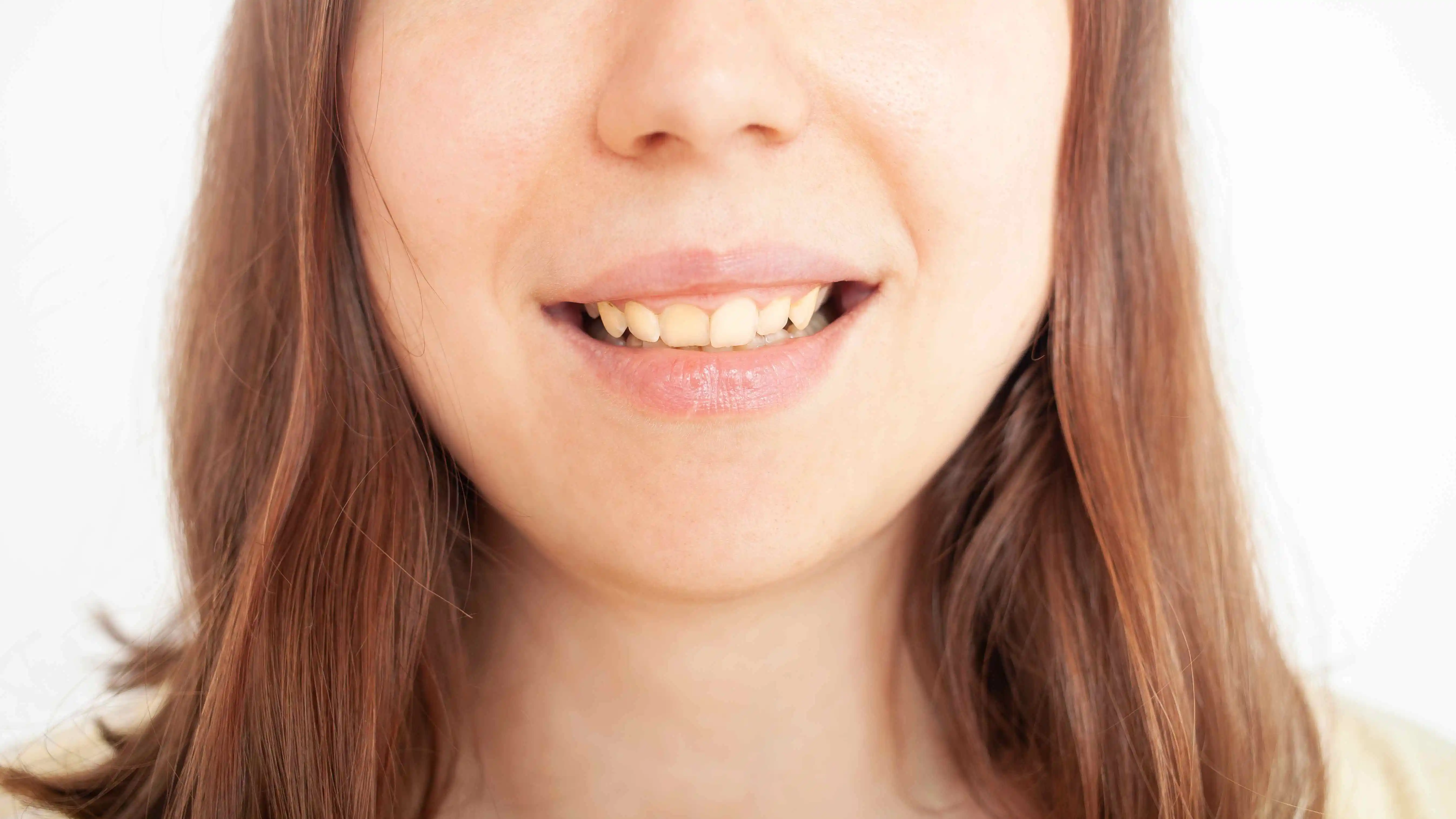 How Do Dental Stains Occur