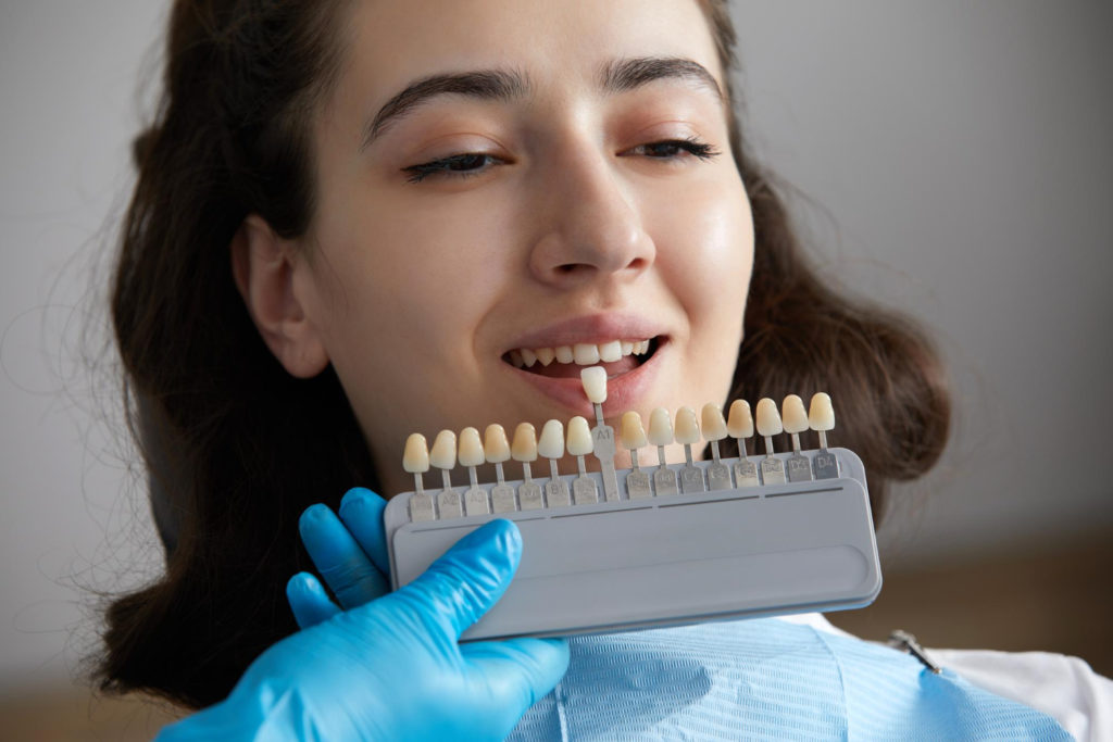 How Long Do Same-Day Dental Crowns Last?