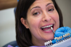 Natural Dental Bridges 