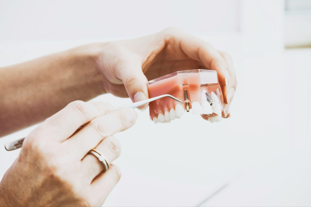 permanent partial dentures